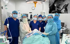 Cảnh giác tai nạn chó cắn: Bé trai 5 tuổi suýt bị hủy hoại gương mặt